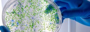 resistencia a los antimicrobianos
