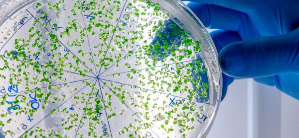 resistencia a los antimicrobianos